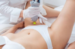 Laser Hair Removal For Intimate Area